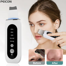 Ultrasonic Skin Scrubber: Deep Cleansing